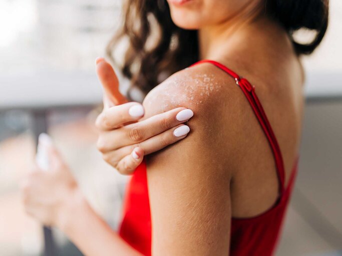 Nahaufnahme einer Frau, die Feuchtigkeitscreme auf sonnenverbrannte Haut aufträgt. | © Getty Images / Eleganza