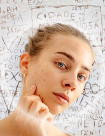 Junge Frau betrachtet ihre Haut und berührt ihr Kinn – Symbolbild für Selbstkritik und die Sympathie, die durch Unvollkommenheit entsteht. | © Getty Images/Maksym Belchenko