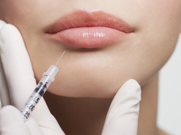 Frau bekommt Lippeninjektion | © Getty Images/Robert Daly