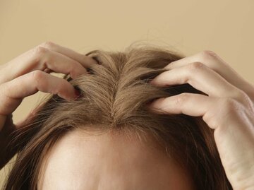 Haaransatz mit Trockenshampoo | © Getty Images/triocean
