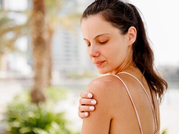 Person mit trockener Haut auf Schultern | © Getty Images/Eleganza