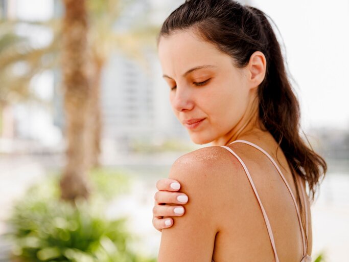 Person mit trockener Haut auf Schultern | © Getty Images/Eleganza