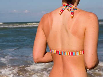 Frau im Bikini hat einen Sonnenbrand am Rücken | © Getty Images/Joel Carillet