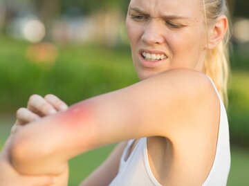 Verärgerte Frau sieht auf einen Stich an ihrem Arm | © Getty Images/PKpix