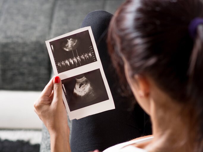 Frau betrachtet Ultraschallbild | © iStock | Milan_Zokic